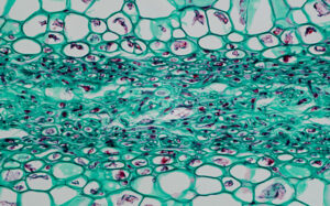 photo of green algae under the microscope